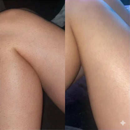 Lotion Triple Acides – Peau Granuleuse & Kératose Pilaire